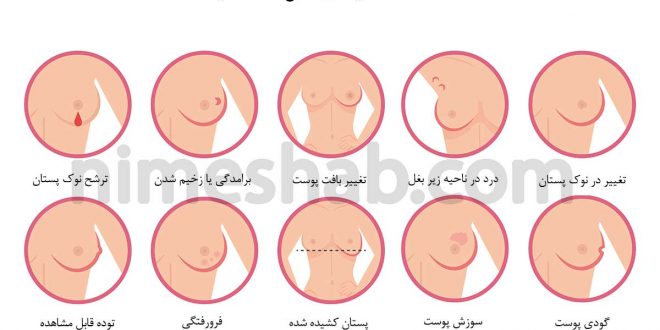 تشخیص سرطان سینه