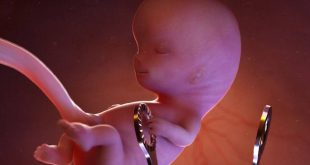 قوانین جدید سقط جنین قانونی 1400
