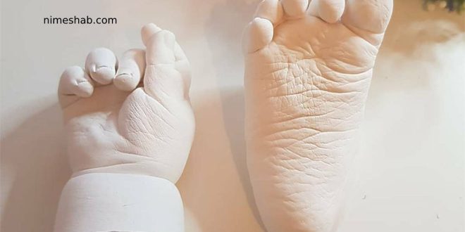 قالب گیری دست و پای نوزاد